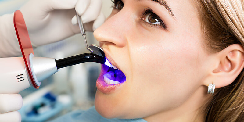 Einfache und preiswerte Behandlung von Karies