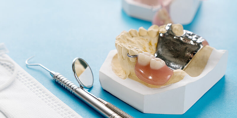 hochwertige Teilprothese zum günstigen Preis